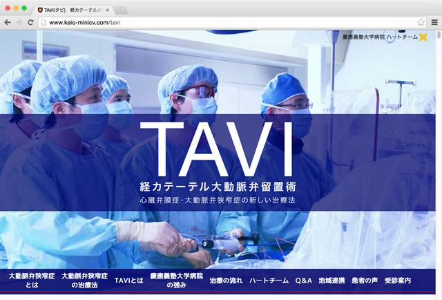 心臓弁膜症・大動脈弁狭窄症の新しい治療法・TAVI(経カテーテル大動脈弁留置術)